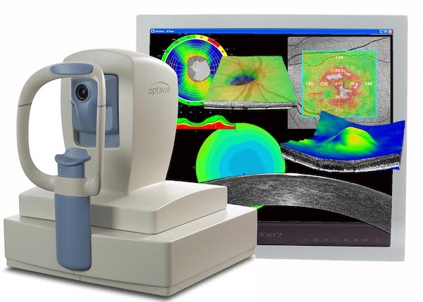 optik-koherens-tomografi-oct