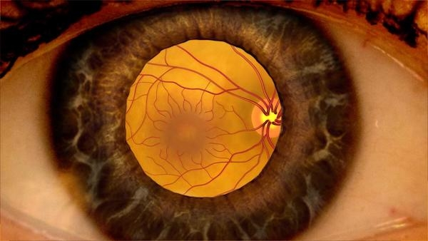 retina-dekolmaninda-tedavi-yontemleri