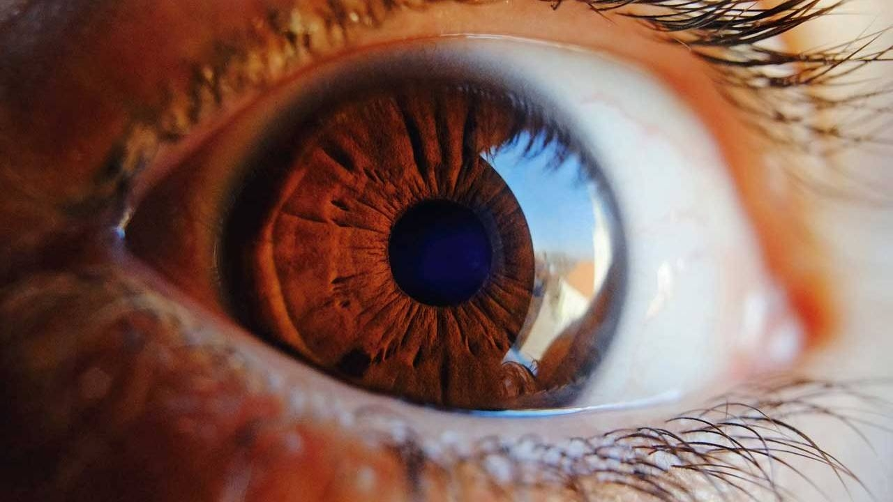 retina-yirtigi