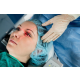 goz-tedavisinde-laser