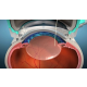 refraktif-cerrahi-miyopi-hipermotropi-astigmat-goz-ici-lensi