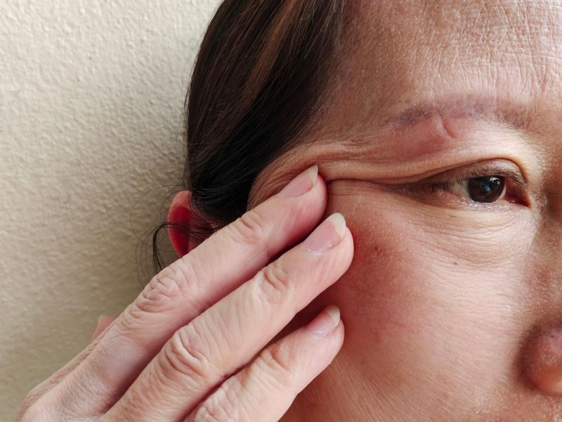 goz-kapagi-operasyonu