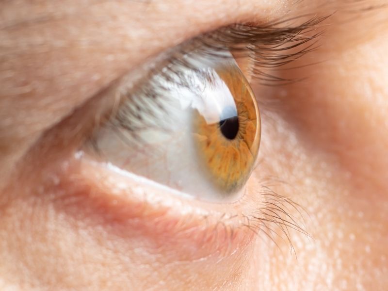 goz-tansiyonu-glokom