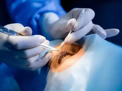 excimer-lazer-tedavisi