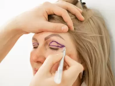 goz-estetigi-ameliyati