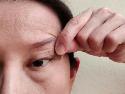 goz-kapagi-dusuklugu-tedavisi