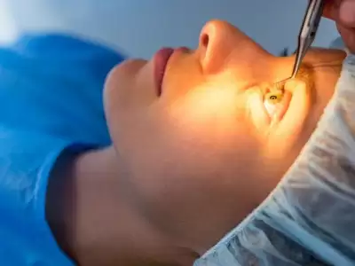 ne-zaman-lasik-yaptirmaliyim