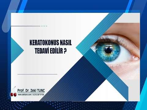 zeki tunç,keratokonus,göz sağlığı,göz hastalıkları,göz kuruluğu