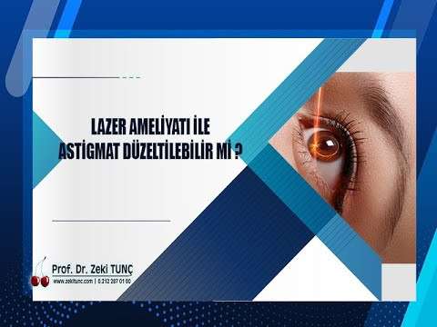 zeki tunç,göz hastalıkları,göz sağlığı,göz kuruluğu,göz bozukluğu,astigmat,miyop,hipermetrop