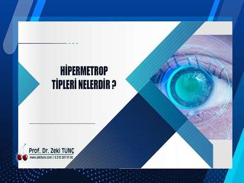 zeki tunç,göz sağlığı,göz hastalıkları,göz ameliyatı,uzağı görememe,yakını görememe,hipermetrop,miyop,astigmat,göz bozukluğu