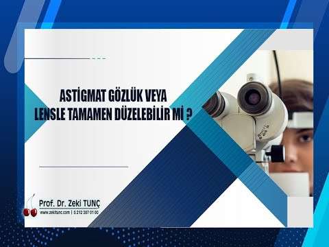 zeki tunç,astigmat,göz bozukluğu,göz kuruluğu