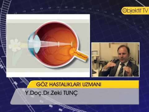 Astigmatism (Disease Or Medical Condition),Health (Industry),keratokonus,keratokonüs,ceratoconus,keratoconus,göz,mercek,astigmat,zeki tunç,lazer,fako,hipermetrop,miyop