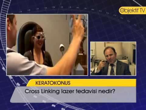 Cross-link,Biology (Media Genre),keratokonus,keratokonüs,ceratoconus,keratoconus,göz,mercek,astigmat,zeki tunç,lazer,fako,hipermetrop,miyop,Corneal Collagen Cross-linking,Health (Industry),Cornea (Anatomical Structure),Laser