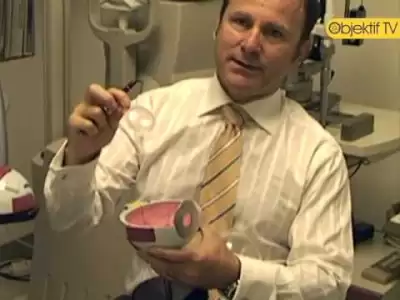 katarakt,cataract,fako,faco,göz,mercek,astigmat,zeki tunç,lazer,hipermetrop,miyop,Health (Industry)