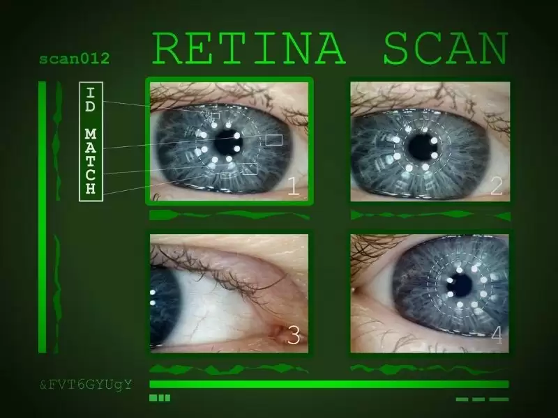 retina-anjiyosu-ffa