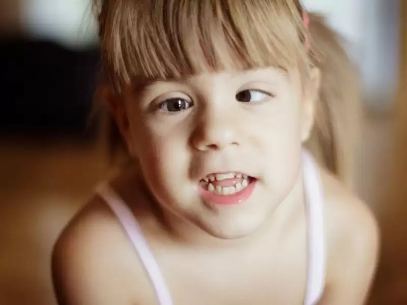 cocuklarda-sasilik-ameliyati