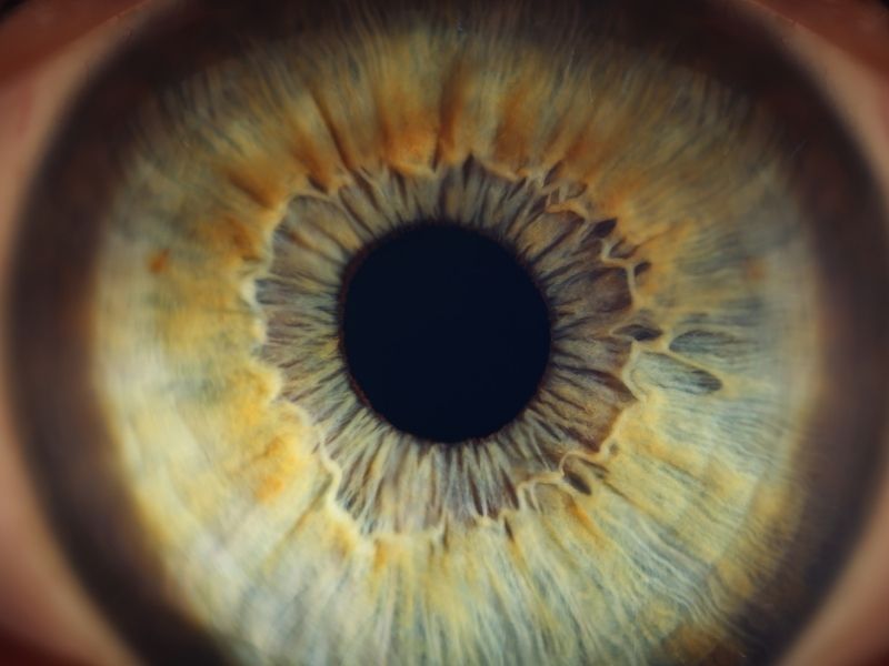 retina-dekolmani-tedavisi-sonrasi-tekrar-riski-var-midir